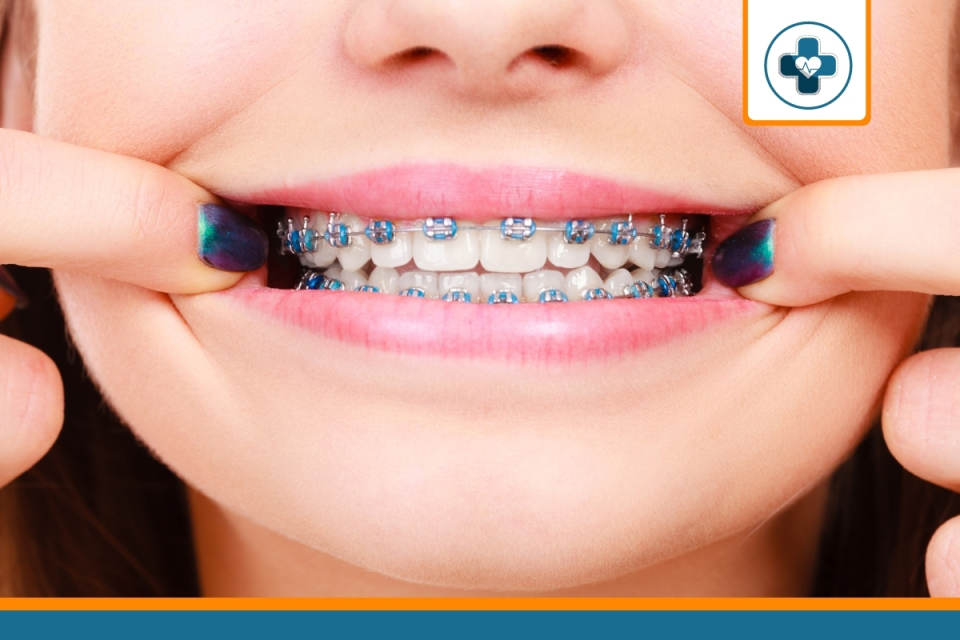 mutuelle avec prise en charge de l'orthodontie